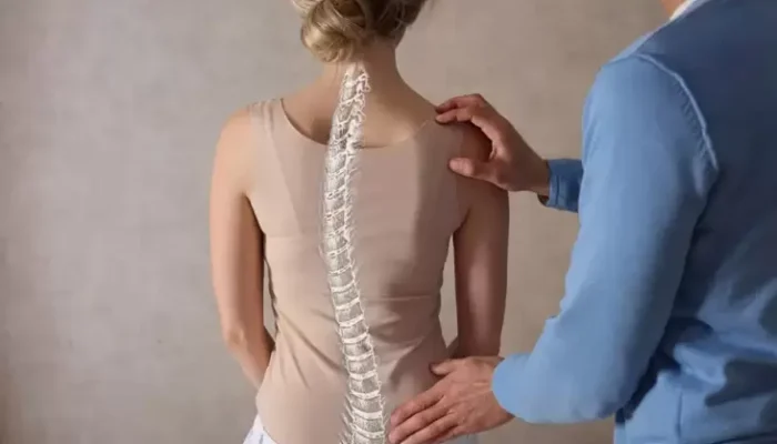 Apakah Chiropractic Bisa Menyembuhkan Skoliosis? Cek Faktanya